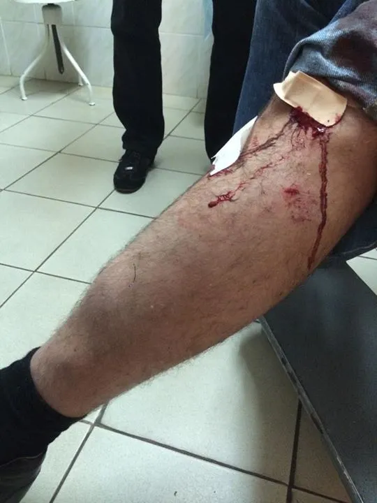 У Києві минулої ночі із молотком, ножем та арматурою невідомі напали на відомого ведучого Андрія Джеджулу (Фото) — фото 1